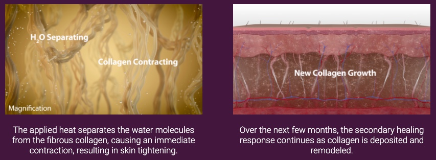 sc 2022-08-25 오전 12.49.31