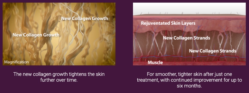 sc 2022-08-25 오전 12.50.38